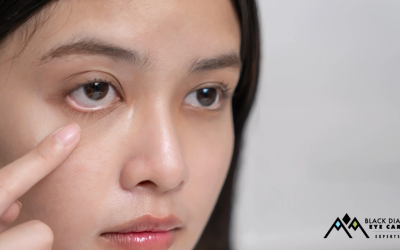 What is Graves’ Eye Disease and How is It Treated?