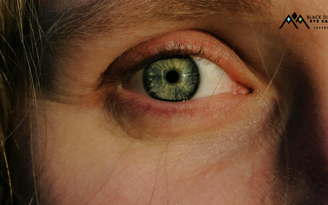 6 Common Eye Infections that Require Treatment
