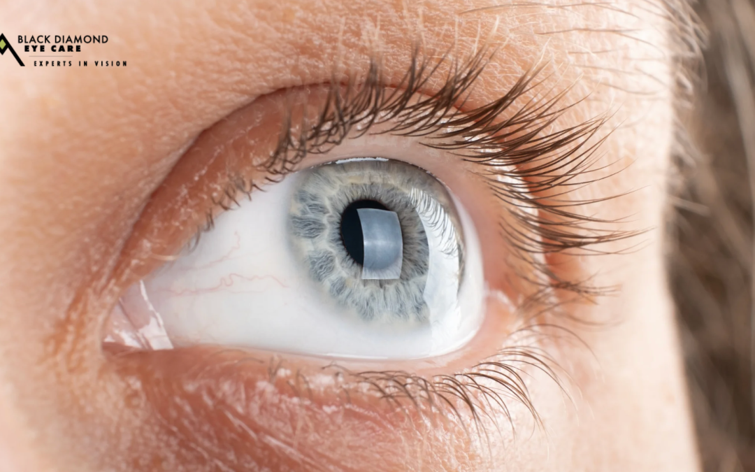 What is a Corneal Abrasion and How it is Treated